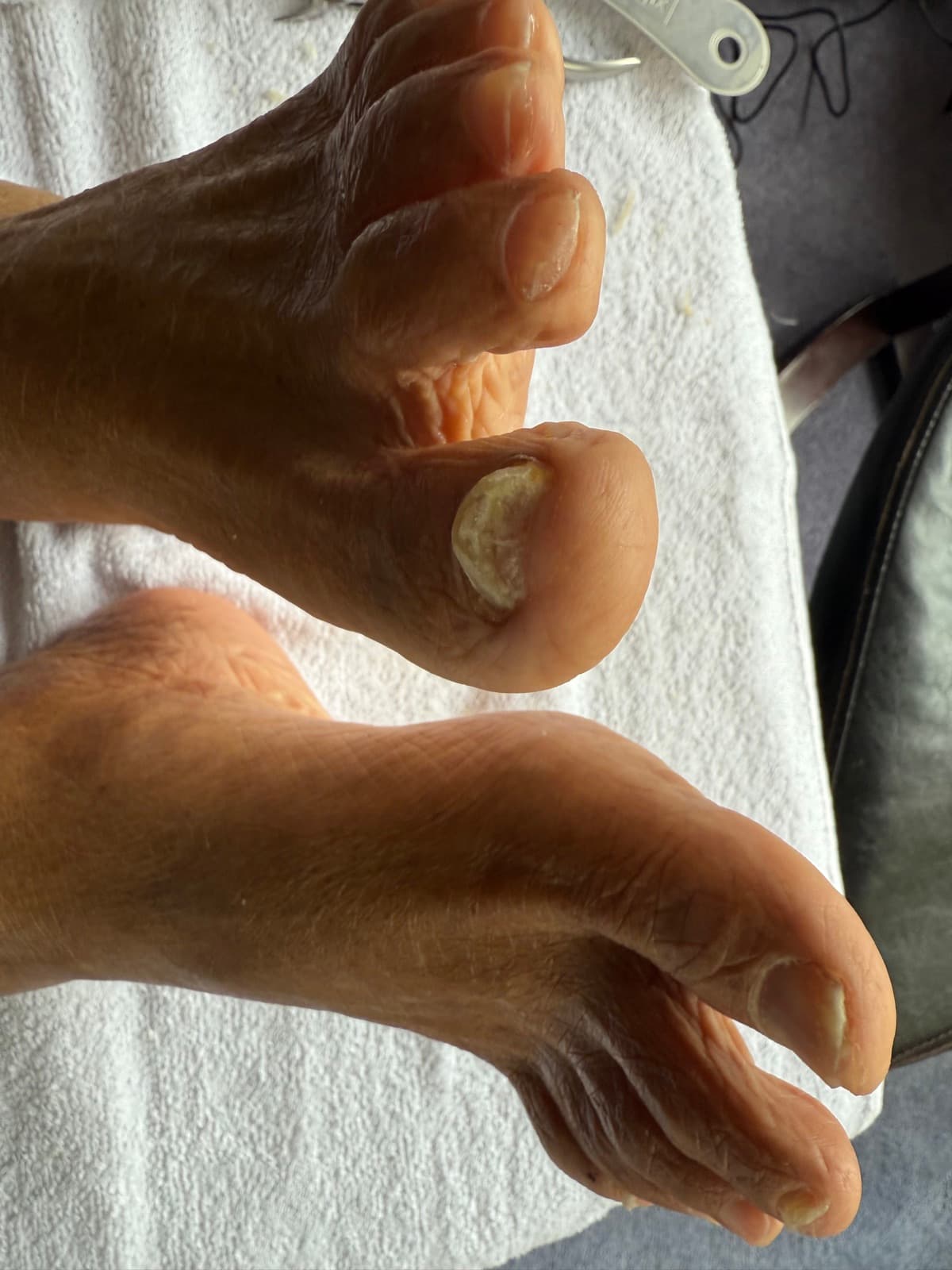 Nurse providing gentle in-home foot care